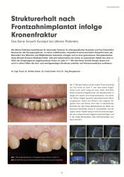 issueImage