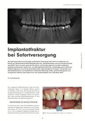 issueImage