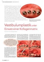 issueImage