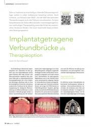 issueImage