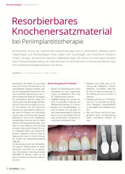 issueImage