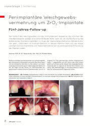 issueImage