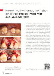 issueImage