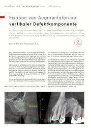 issueImage