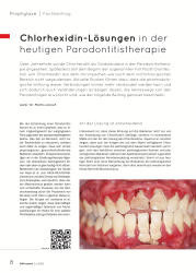 issueImage