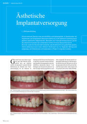 issueImage