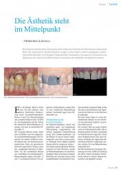 issueImage