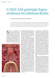 issueImage