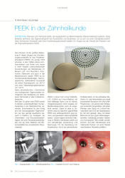 issueImage