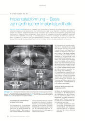 issueImage