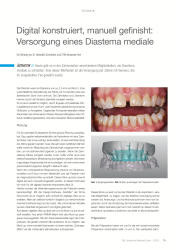 issueImage