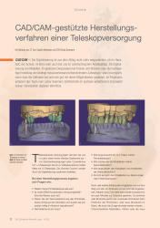 issueImage