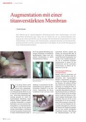 issueImage