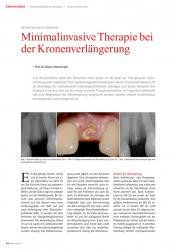issueImage