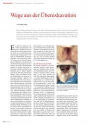 issueImage