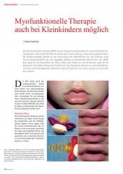 issueImage