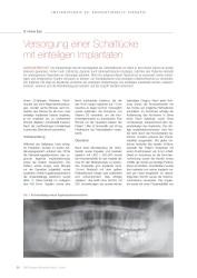 issueImage