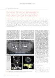 issueImage
