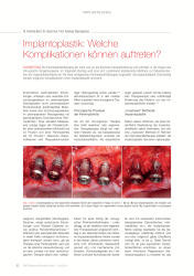 issueImage