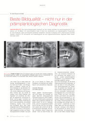 issueImage