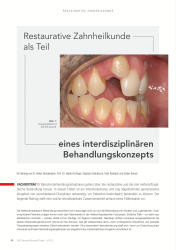 issueImage