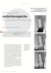 issueImage