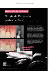 issueImage