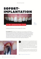 issueImage