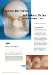 issueImage