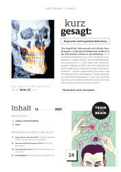 issueImage