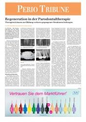 issueImage