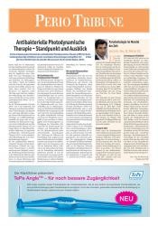 issueImage