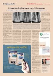 issueImage