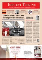 issueImage