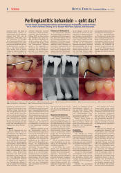 issueImage
