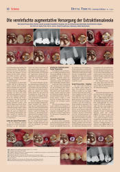 issueImage