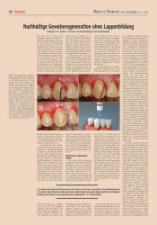 issueImage