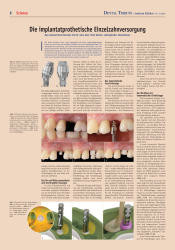 issueImage