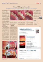issueImage