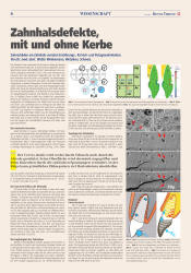 issueImage