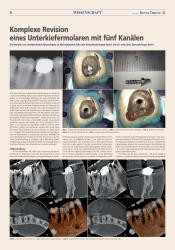 issueImage