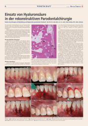 issueImage