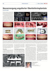 issueImage