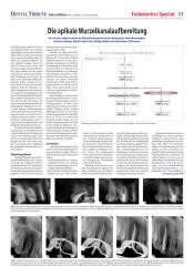 issueImage