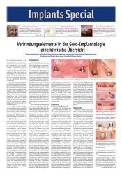 issueImage