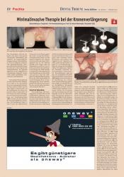 issueImage