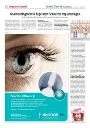 issueImage