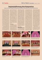 issueImage