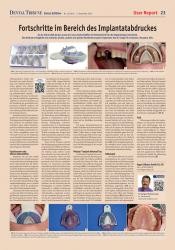 issueImage
