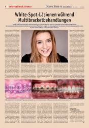 issueImage